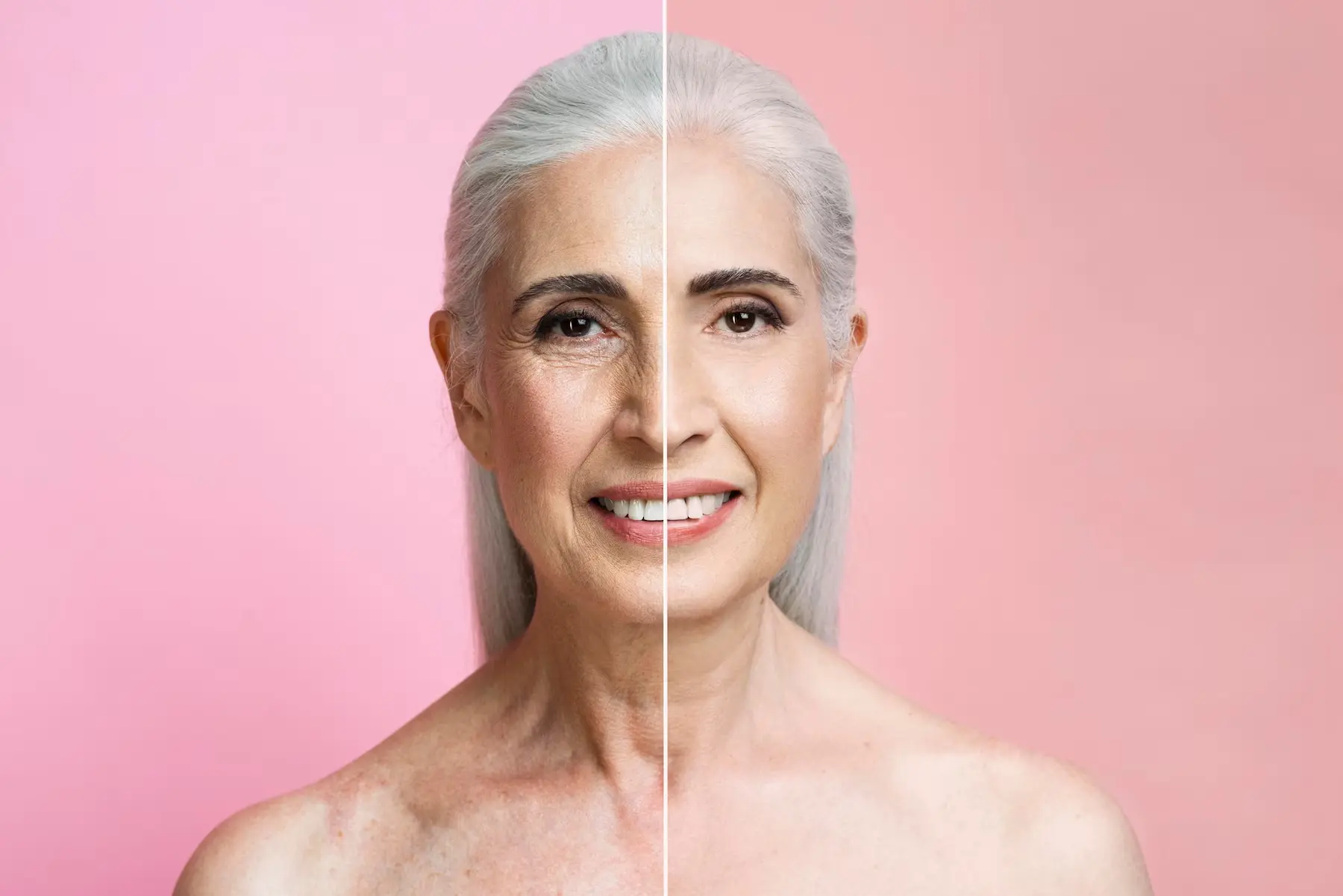 Face Filling